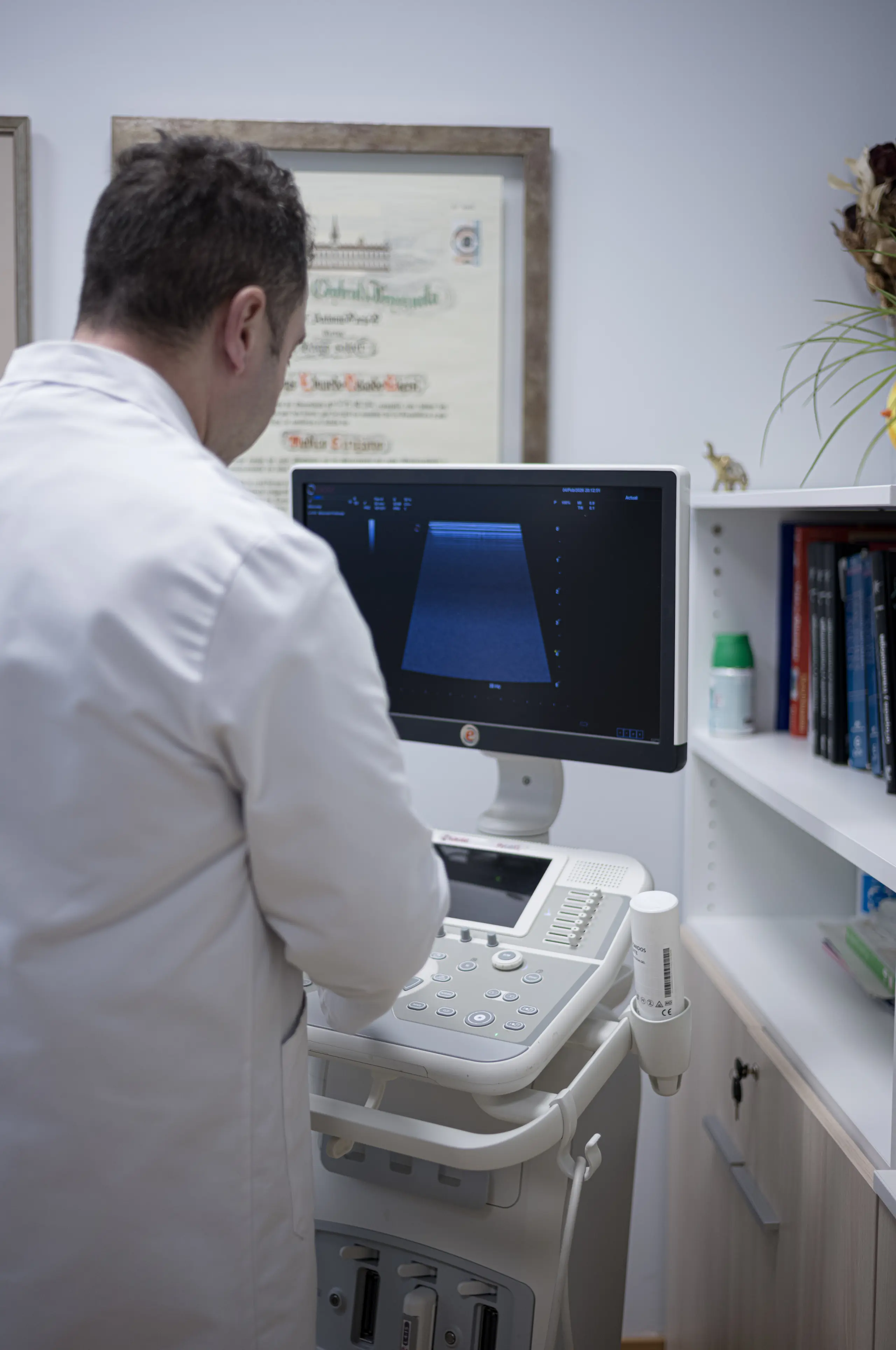 Fractura de pilón tibial sin afectación articular