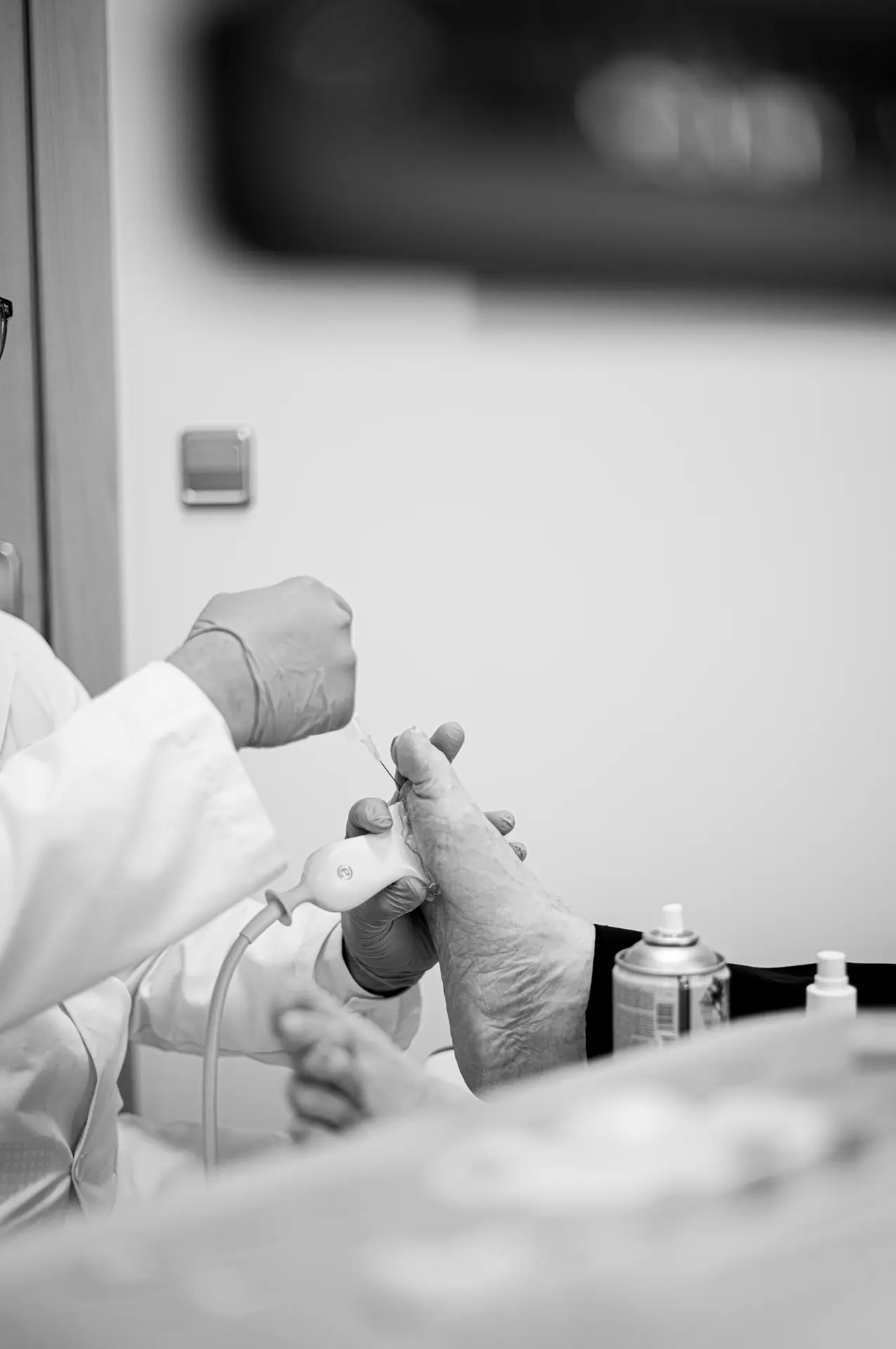 Hallux rígido queilectomía — Preservación articular
