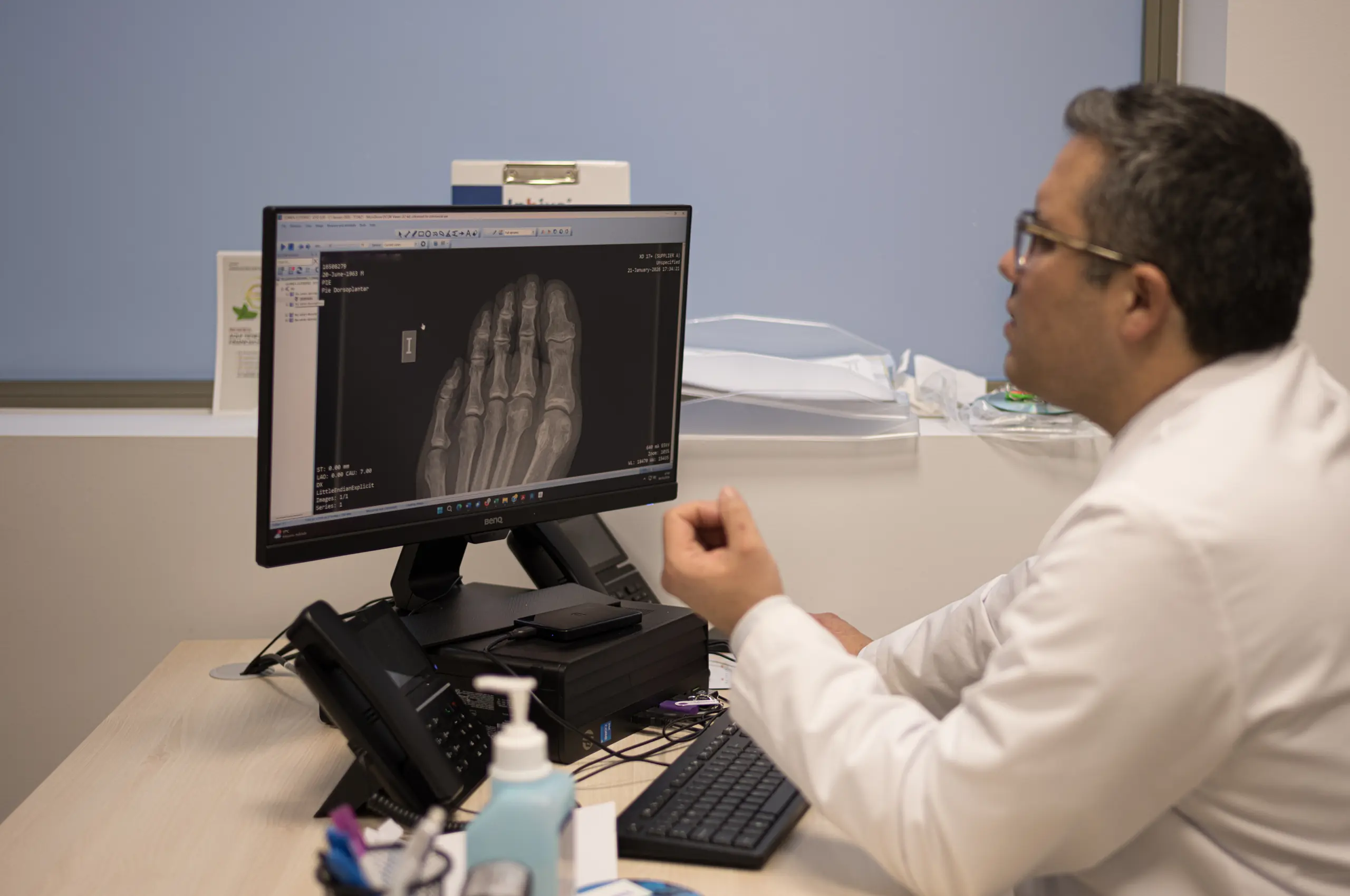 Inestabilidad de tobillo: ligamentoplastia +/- lesión condral + osteotomía de calcáneo