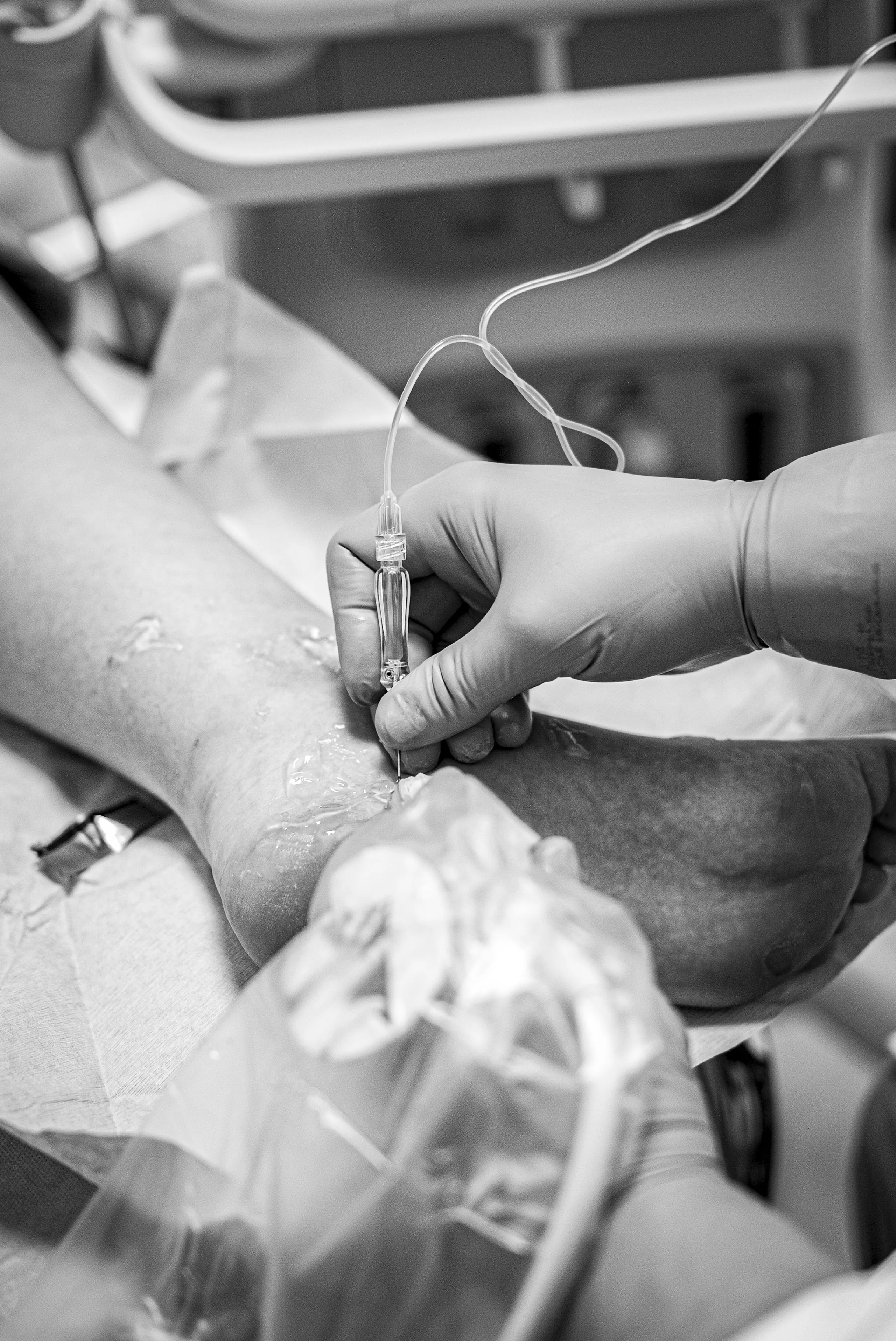 Inestabilidad de tobillo: reconstrucción de ligamentos +/- lesión condral + osteotomía de calcáneo