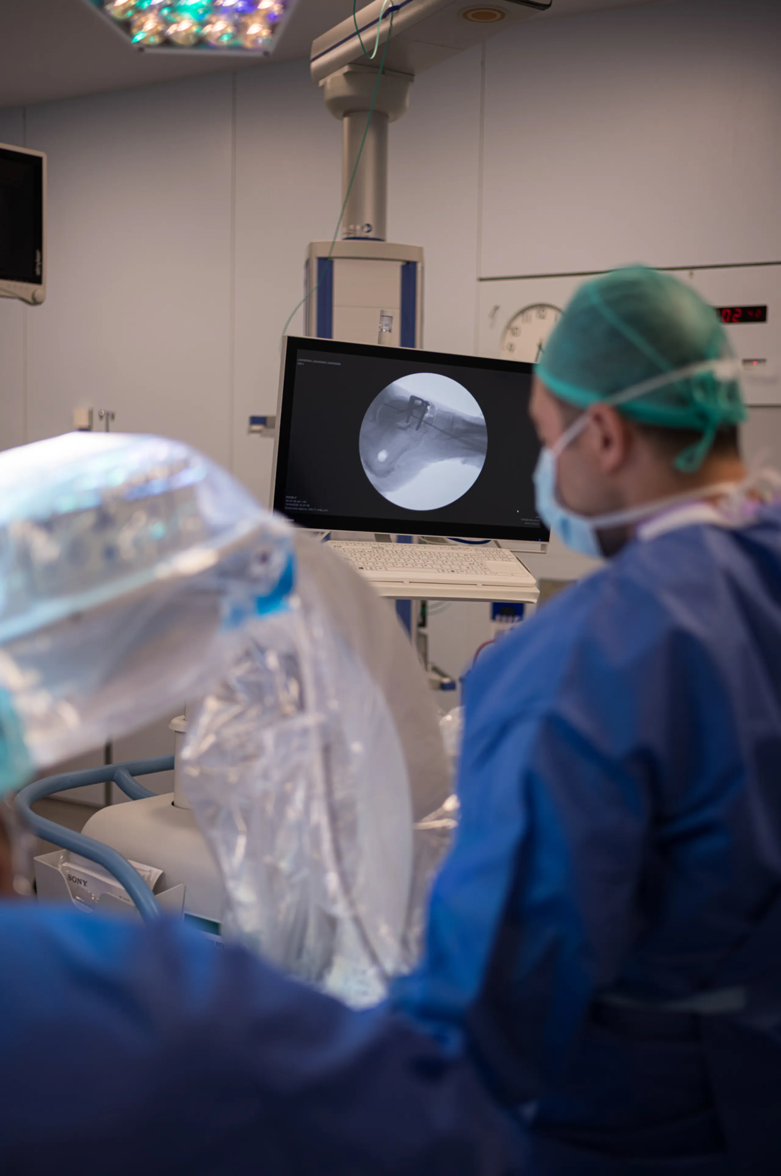 Reemplazo Articular para Artrosis Terminal