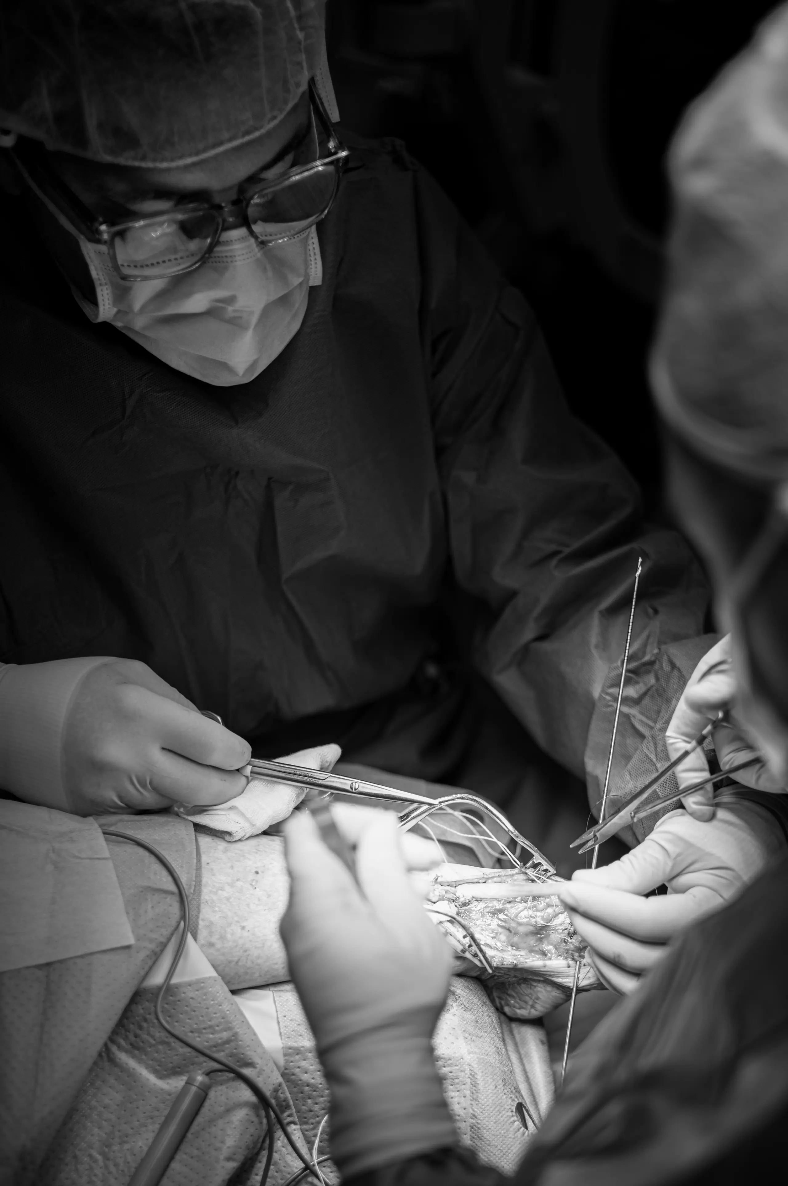 Osteotomía Correctora